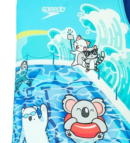 DIGI PLMT ALV 1PC IF